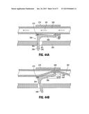 SYSTEMS AND METHODS FOR TREATING TISSUE WITH RADIOFREQUENCY ENERGY diagram and image