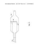 MEDICAL DEVICE FOR SYMPATHETIC NERVE ABLATION WITH PRINTED COMPONENTS diagram and image