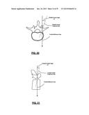 Surgical Monitoring System and Related Methods diagram and image