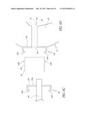 APPARATUS AND METHODS FOR TREATING ROOT CANALS OF TEETH diagram and image