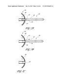 DELIVERY SYSTEM FOR INFLATABLE IMPLANT diagram and image