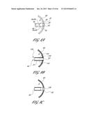 DELIVERY SYSTEM FOR INFLATABLE IMPLANT diagram and image