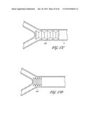 DELIVERY SYSTEM FOR INFLATABLE IMPLANT diagram and image