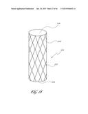 DELIVERY SYSTEM FOR INFLATABLE IMPLANT diagram and image