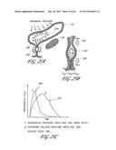 DELIVERY SYSTEM FOR INFLATABLE IMPLANT diagram and image