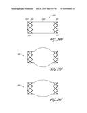 DELIVERY SYSTEM FOR INFLATABLE IMPLANT diagram and image