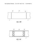 DELIVERY SYSTEM FOR INFLATABLE IMPLANT diagram and image