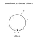 DELIVERY SYSTEM FOR INFLATABLE IMPLANT diagram and image