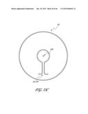 DELIVERY SYSTEM FOR INFLATABLE IMPLANT diagram and image