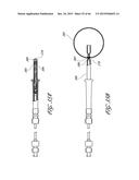 DELIVERY SYSTEM FOR INFLATABLE IMPLANT diagram and image