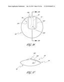 DELIVERY SYSTEM FOR INFLATABLE IMPLANT diagram and image