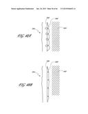 DELIVERY SYSTEM FOR INFLATABLE IMPLANT diagram and image