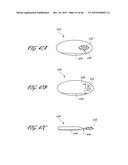 DELIVERY SYSTEM FOR INFLATABLE IMPLANT diagram and image