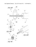 DELIVERY SYSTEM FOR INFLATABLE IMPLANT diagram and image