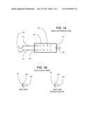 SURGICAL IMPLANTABLE STABILIZER SLING FOR BASAL JOINT ARTHROPLASTY diagram and image