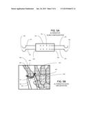 SURGICAL IMPLANTABLE STABILIZER SLING FOR BASAL JOINT ARTHROPLASTY diagram and image