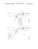 APPARATUS AND METHOD FOR DRAINING MATERIAL FROM A STOMACH diagram and image