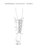 COMPRESSION DEVICE diagram and image