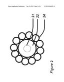 Nanomagnetic modification of angiography contrast dye and a novel process     for its removal using intravascular catheter based electromagnet system. diagram and image