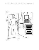 Nanomagnetic modification of angiography contrast dye and a novel process     for its removal using intravascular catheter based electromagnet system. diagram and image