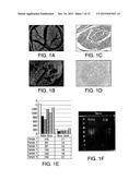 INJECTABLE PERIPHERAL NERVE SPECIFIC HYDROGEL diagram and image