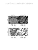 INJECTABLE PERIPHERAL NERVE SPECIFIC HYDROGEL diagram and image