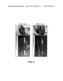 INJECTABLE PERIPHERAL NERVE SPECIFIC HYDROGEL diagram and image