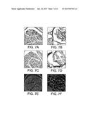 INJECTABLE PERIPHERAL NERVE SPECIFIC HYDROGEL diagram and image