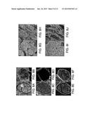 INJECTABLE PERIPHERAL NERVE SPECIFIC HYDROGEL diagram and image