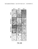 INJECTABLE PERIPHERAL NERVE SPECIFIC HYDROGEL diagram and image