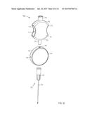 SYSTEMS AND METHODS FOR DELIVERING A FLUID TO A PATIENT WITH REDUCED     CONTAMINATION diagram and image