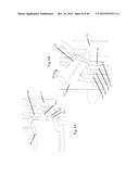 Portable Drug Mixing and Delivery Device and Associated Methods diagram and image