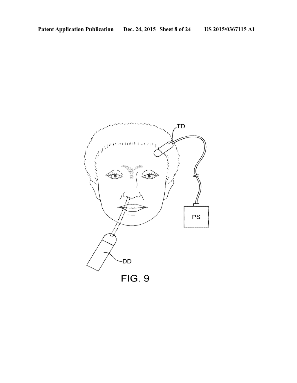 METHODS AND SYSTEMS FOR TOXIN DELIVERY TO THE NASAL CAVITY - diagram, schematic, and image 09