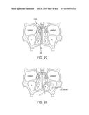 METHODS AND SYSTEMS FOR TOXIN DELIVERY TO THE NASAL CAVITY diagram and image
