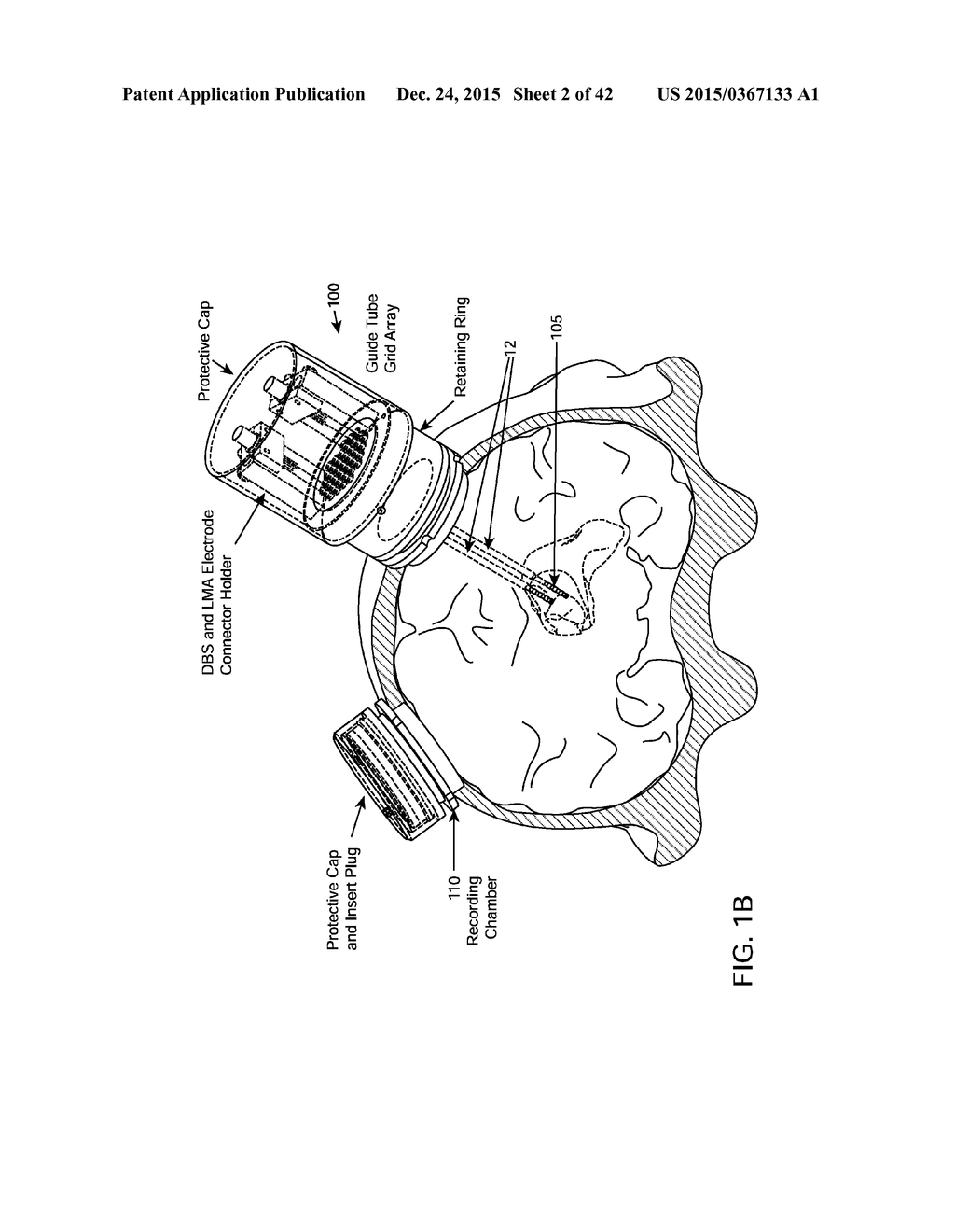 SYSTEM AND METHODS FOR MULTI-SITE ACTIVATION OF THE THALAMUS - diagram, schematic, and image 03