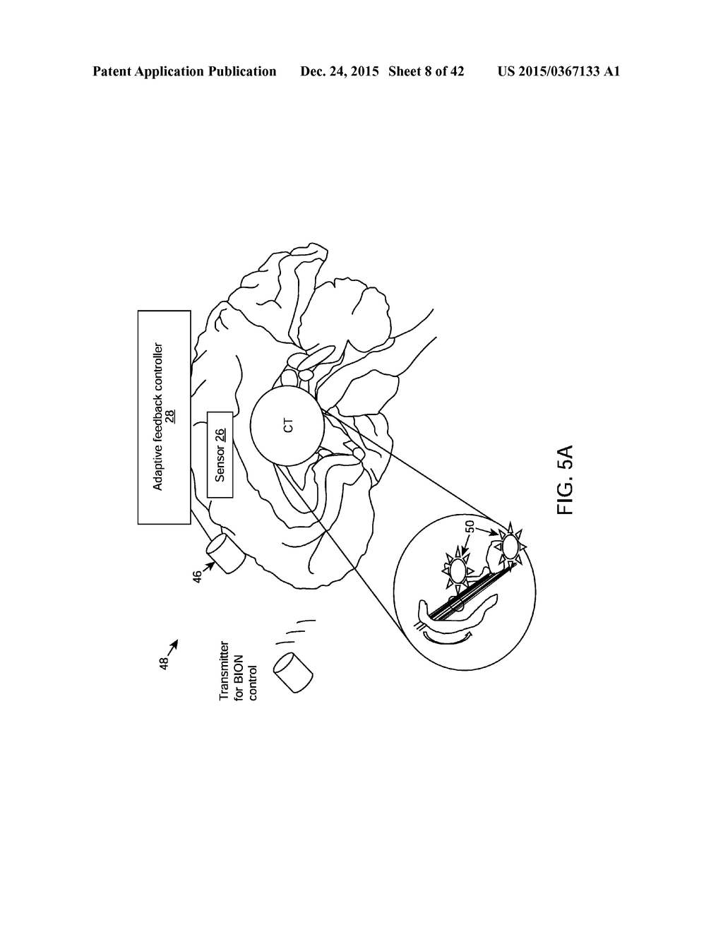 SYSTEM AND METHODS FOR MULTI-SITE ACTIVATION OF THE THALAMUS - diagram, schematic, and image 09