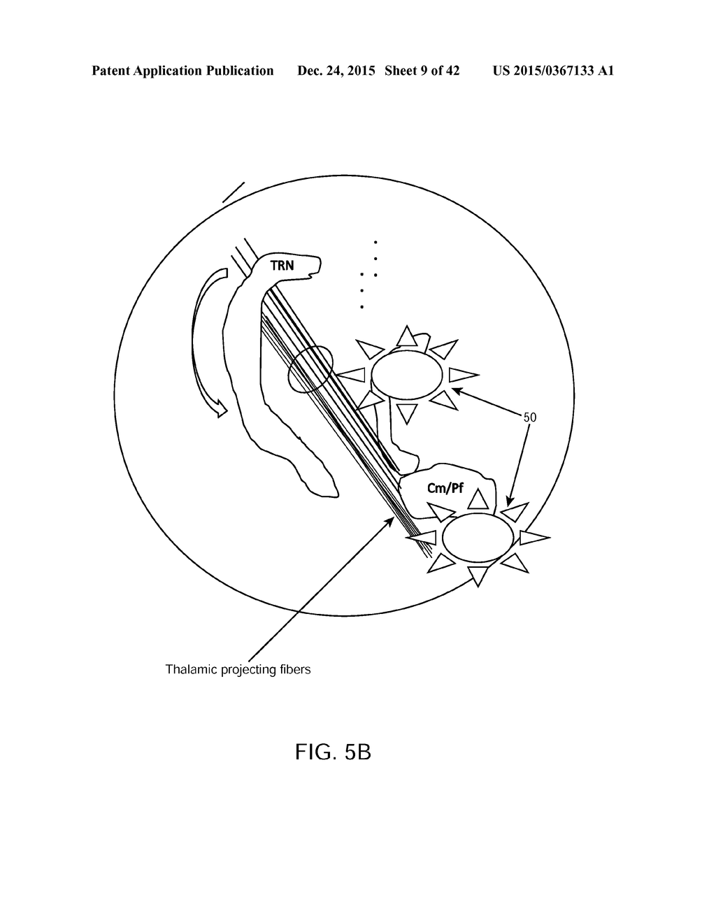 SYSTEM AND METHODS FOR MULTI-SITE ACTIVATION OF THE THALAMUS - diagram, schematic, and image 10