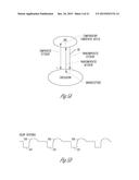 AUTONOMIC MODULATION USING TRANSIENT RESPONSE WITH INTERMITTENT NEURAL     STIMULATION diagram and image