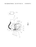 APPARATUS AND METHOD TO OPTIMIZE PACING PARAMETERS diagram and image