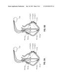 APPARATUS AND METHOD TO OPTIMIZE PACING PARAMETERS diagram and image