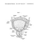 APPARATUS FOR THE GENERATION OF AN ENERGY FIELD FOR THE TREATMENT OF     CANCER IN BODY CAVITIES AND PARTS THAT ARE CAVITY-LIKE diagram and image