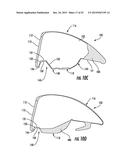 Golf Club Head or Other Ball Striking Device Having Impact-Influencing     Body Features diagram and image