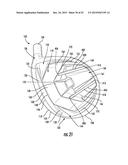 Golf Club Head or Other Ball Striking Device Having Impact-Influencing     Body Features diagram and image