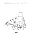 Golf Club Head or Other Ball Striking Device Having Impact-Influencing     Body Features diagram and image