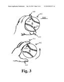 RAISED SEEM BASEBALL TRAINING DEVICE diagram and image