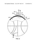 Basketball Training Device diagram and image