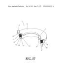 MICRO-CHANNEL FLUID FILTERS AND METHODS OF USE diagram and image