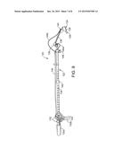 Stabilization of an End of an Extended-Reach Apparatus in a Limited-Access     Space diagram and image