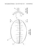 HIGH ALTITUDE BALLOON AND METHOD AND APPARATUS FOR ITS MANUFACTURE diagram and image