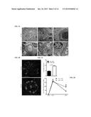 ANTI-HISTONE THERAPY FOR VASCULAR NECROSIS IN SEVERE GLOMERULONEPHRITIS diagram and image